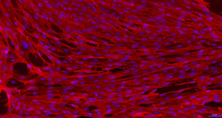 Primary Rabbit Vaginal Smooth Muscle Cells (VSMC)