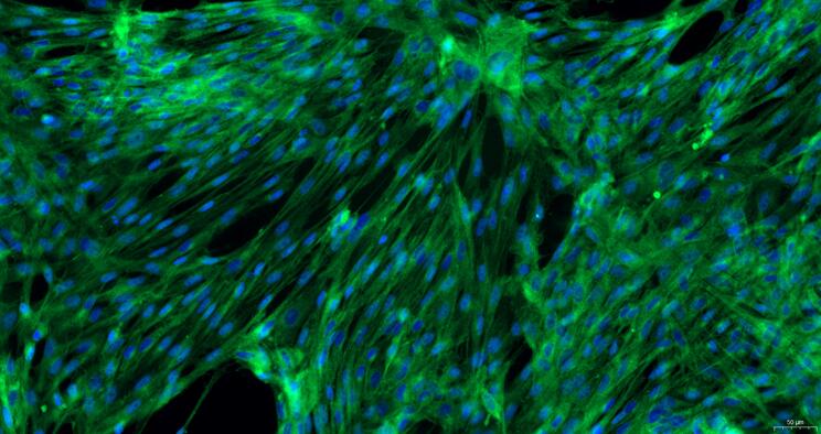 Primary Rabbit Vaginal Smooth Muscle Cells (VSMC)