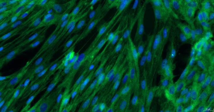 Primary Rabbit Vaginal Smooth Muscle Cells (VSMC)