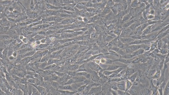 Primary Rat Inferior Vena Cava Smooth Muscle Cells ( IVCSMC)