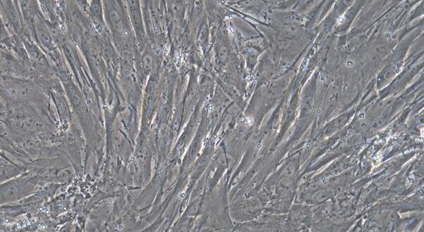 Primary Rabbit Endocardial Fibroblasts (EnCF)