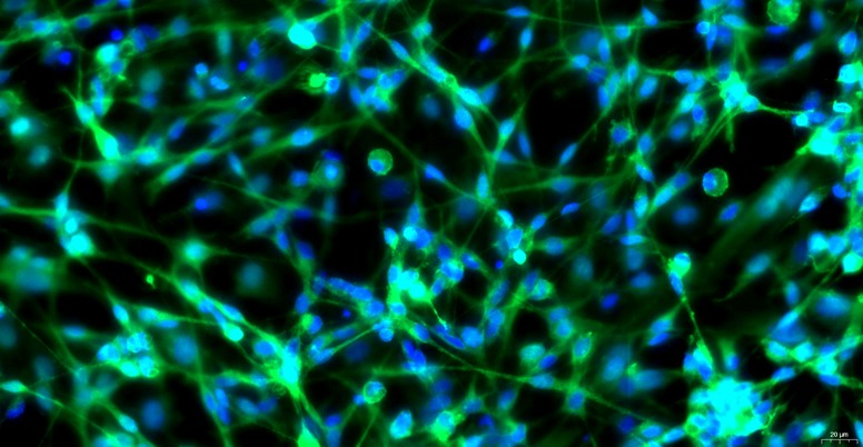 Primary Canine Dorsal Root Ganglion Neuron Cells (DRGN)