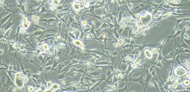 Primary Rat Dorsal Root Ganglion Neuron Cells (DRGN)