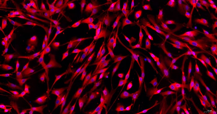 Primary Feline Aorta Adventitial Fibroblasts (AAF)
