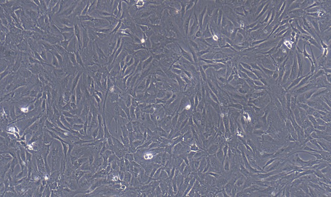 Primary Rat Aorta Adventitial Fibroblasts (AAF)