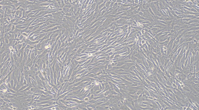 Primary Rabbit Aorta Adventitial Fibroblasts (AAF)