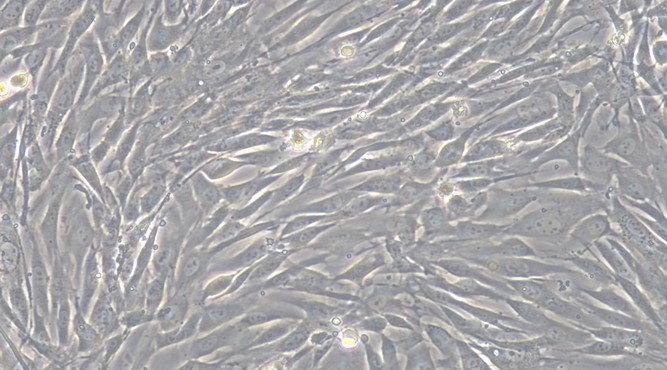 Primary Rabbit Aorta Adventitial Fibroblasts (AAF)