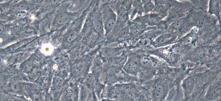 Primary Rabbit Retinal Muller Cells (RMCs)