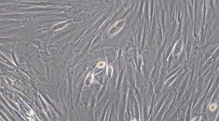 Primary Feline Epididymal Smooth Muscle Cells (EpSMC)
