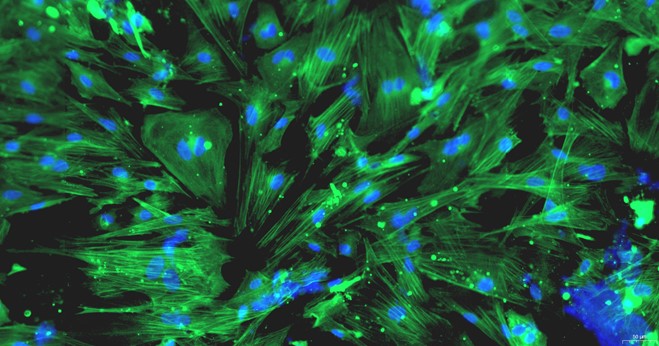 Primary Rat Seminal Vesicle Smooth Muscle Cells (SVSMC)