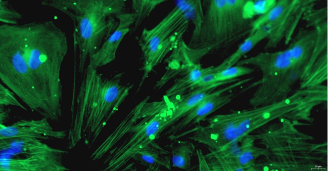 Primary Rat Seminal Vesicle Smooth Muscle Cells (SVSMC)