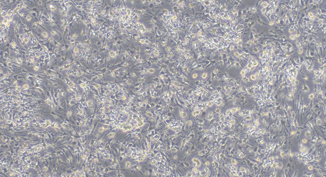 Primary Mouse Olfactory Bulb Neuron Cells (OBNC)