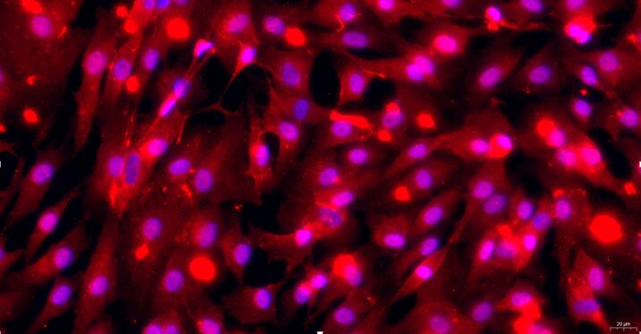 Primary Canine Peripheral Sciatic Nerve Fibroblasts ( PSNC)