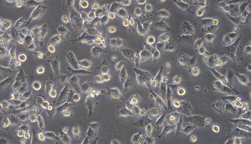 Human Calu-6  Cung Adenocarcinoma Cells (Calu-6)