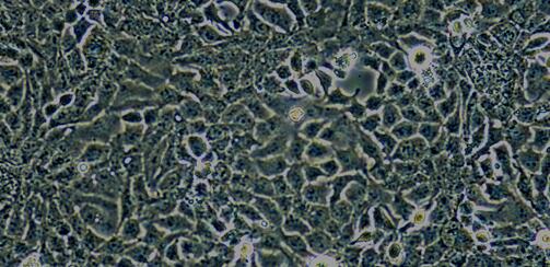 Human Ishikawa Endometrial Cancer Cells (Ishikawa)