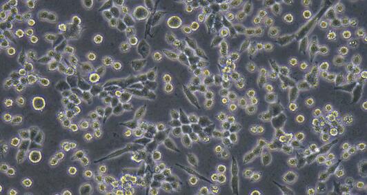 Mouse Lewis Lung Carcinoma Cells (LLC)