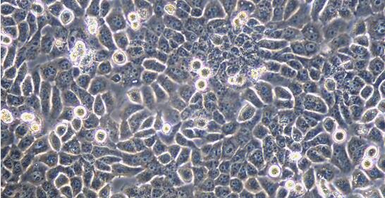 Human NPC/HK-1 Nasopharyngeal Carcinoma Cells (NPC/HK-1)