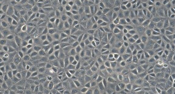 Rat WB-F344 Hepatic Stellate Cells (WB-F344)