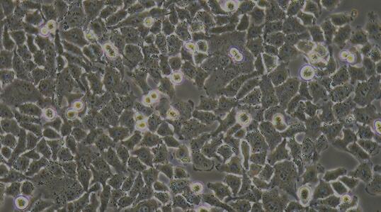Human Huh7 Hepatocellular Carcinoma Cells (Huh7)
