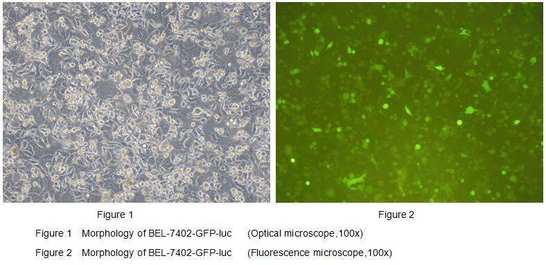 Human Luciferase BEL-7402 Hepatocellular Carcinoma Cells (BEL-7402-GFP-Luc	)