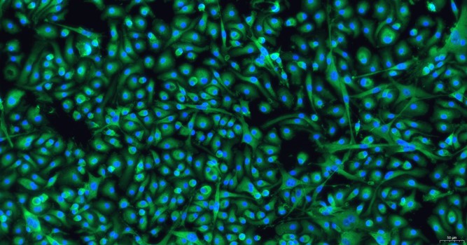 Primary Mouse Bone Marrow-Derived Macrophage Cells (BMDM)