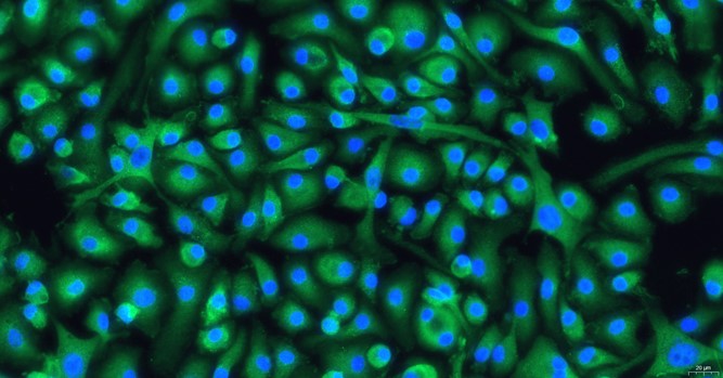 Primary Mouse Bone Marrow-Derived Macrophage Cells (BMDM)