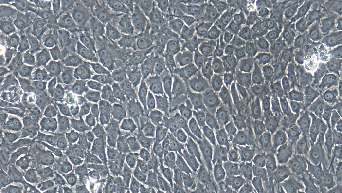Primary Porcine Trigeminal Ganglion Astrocytes (TGA)
