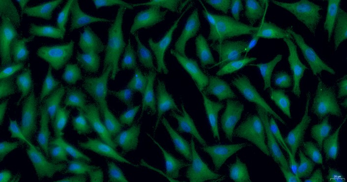 Primary Rabbit Trigeminal Ganglion Astrocytes (TGA)