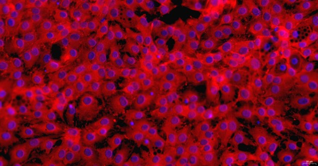 Primary Rat Synovial Mesenchymal Stem Cells (SMSC)