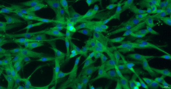 Primary Canine Optic Nerve Astrocytes (ONA)