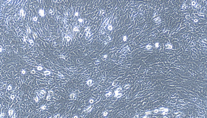 Primary Mouse Peritoneal Fibroblasts (PF)