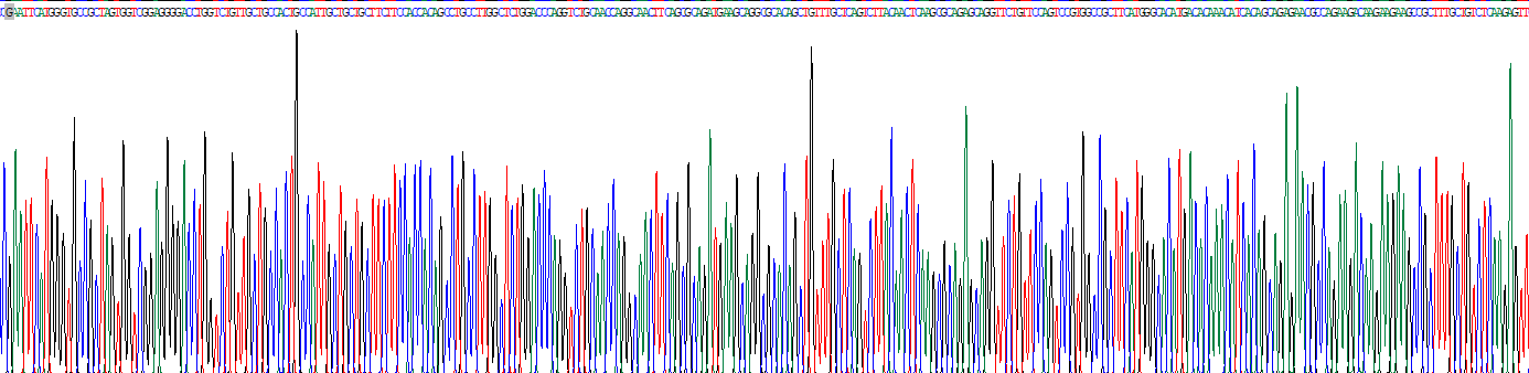 Eukaryotic Angiotensin I Converting Enzyme (ACE)