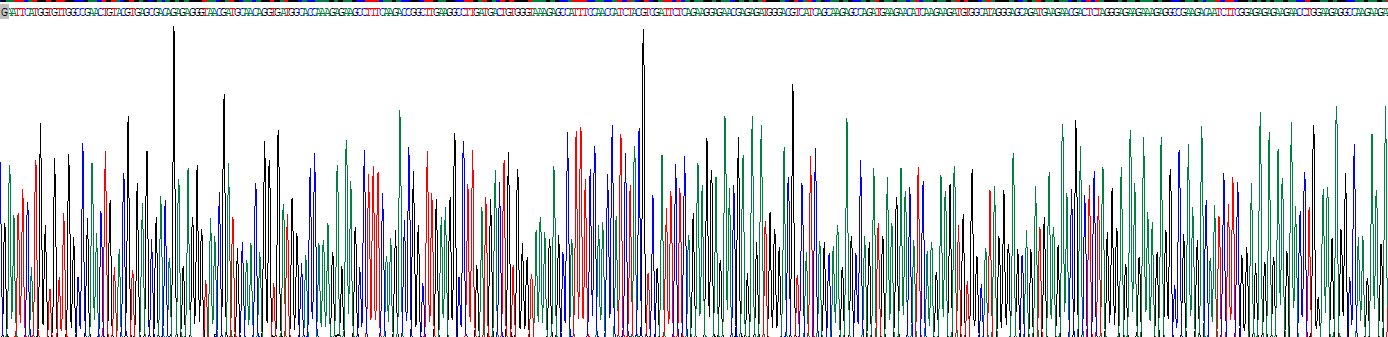 Eukaryotic Asparaginyl tRNA Synthetase (NARS)