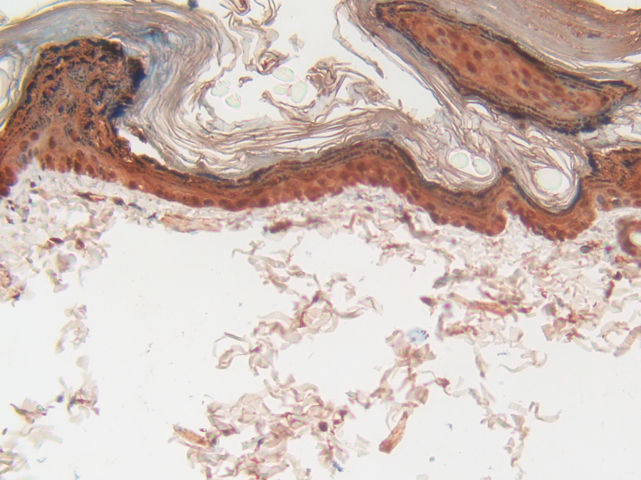 Biotin-Linked Polyclonal Antibody to Cystatin A (CSTA)