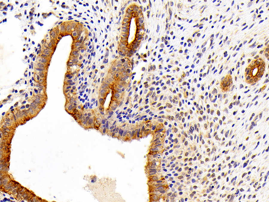 Biotin-Linked Polyclonal Antibody to Cytokeratin 7 (CK7)