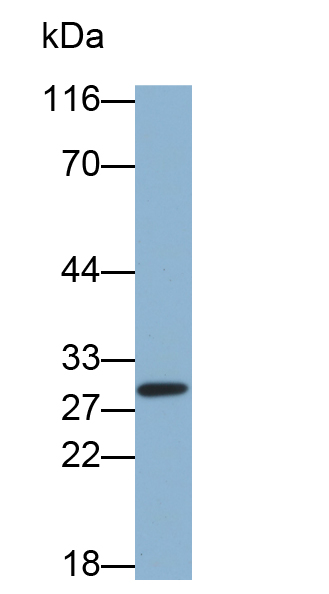 Biotin-Linked Polyclonal Antibody to Glutathione S Transferase Mu 2 (GSTM2)