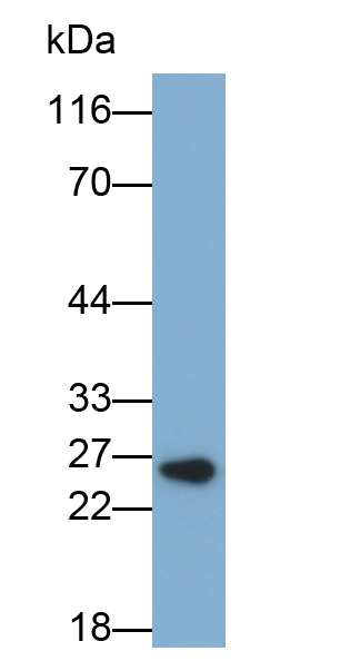 Biotin-Linked Polyclonal Antibody to Glutathione S Transferase Mu 2 (GSTM2)