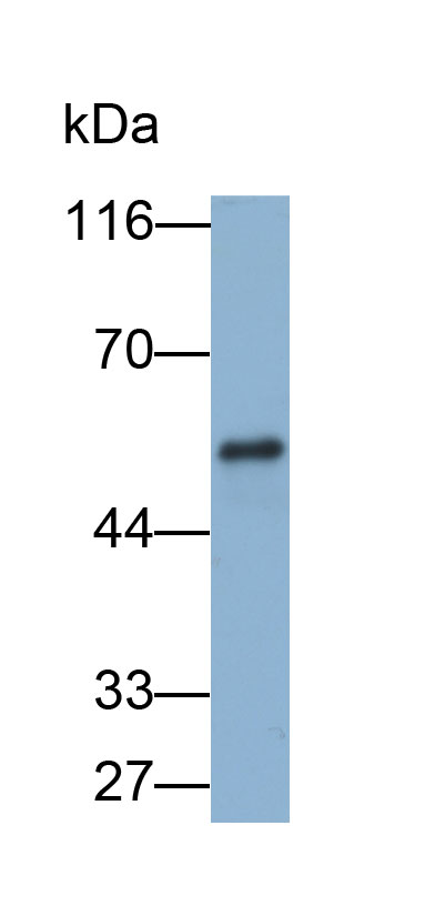 Biotin-Linked Polyclonal Antibody to Lipase, Hepatic (LIPC)