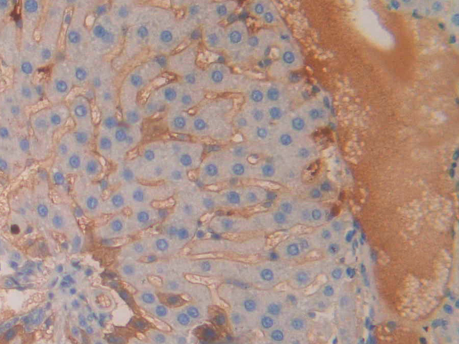 Biotin-Linked Polyclonal Antibody to Corticosteroid Binding Globulin (CBG)