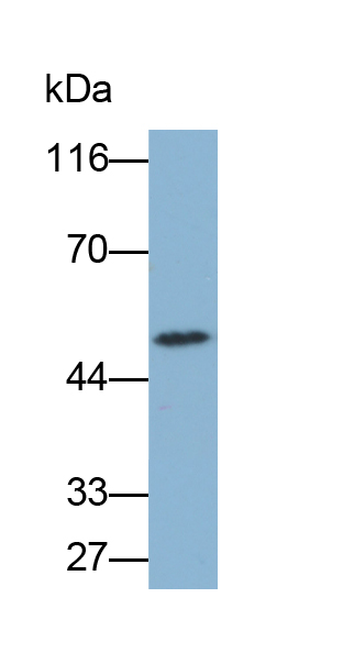 Biotin-Linked Polyclonal Antibody to Interleukin 6 Receptor (IL6R)