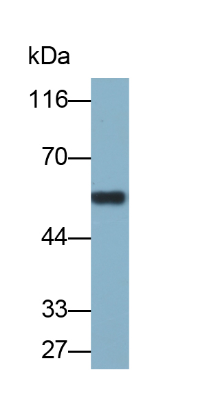 Biotin-Linked Polyclonal Antibody to Activin A Receptor Type II B (ACVR2B)