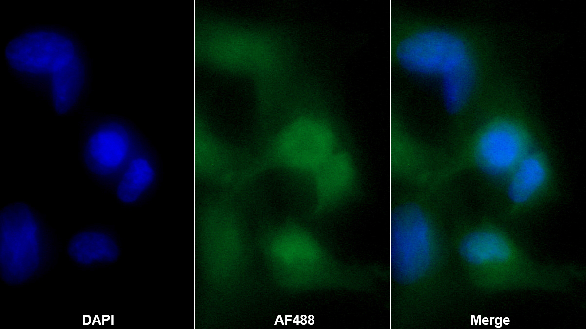 Labelled Monoclonal Antibody to Tau-Tubulin Kinase 2 (tTBK2)