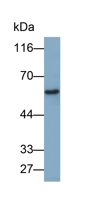 Biotin-Linked Polyclonal Antibody to POTE Ankyrin Domain Family, Member G (POTEG)