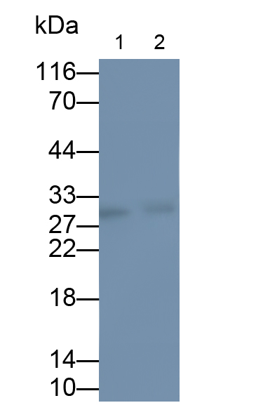 Monoclonal Antibody to Brain Derived Neurotrophic Factor (BDNF)