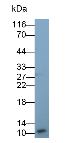 Monoclonal Antibody to S100 Calcium Binding Protein (S100)