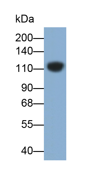 Monoclonal Antibody to E-cadherin