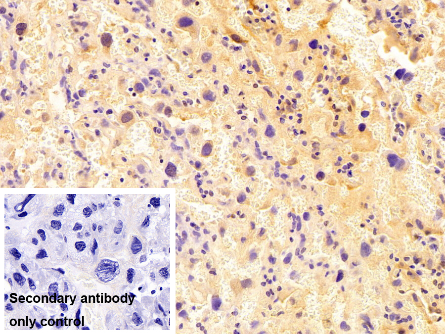 Monoclonal Antibody to Glycoprotein 130 (gp130)