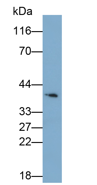Monoclonal Antibody to Inhibin Beta E (INHbE)
