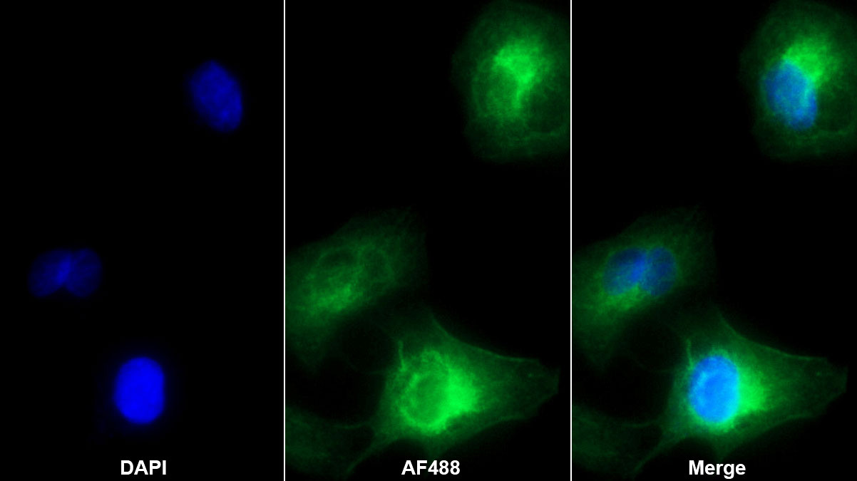 Monoclonal Antibody to Insulin Like Growth Factor Binding Protein 1 (IGFBP1)