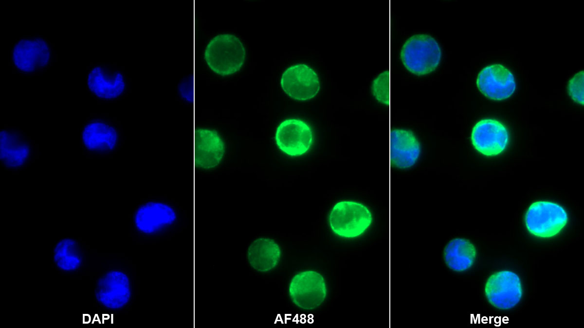 Monoclonal Antibody to Interleukin 12B (IL12B)